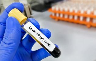 la main d'un scientifique tient un tube à essai qui est prêt pour le test covid-19 igg en laboratoire. photo