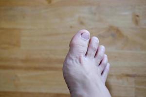 pieds féminins fermés avec des ongles français sur parquet, soins sains et concept médical photo