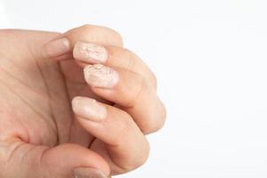 liquide pour l'enlèvement à domicile du vernis à ongles en gel en action sur la main d'une femme photo