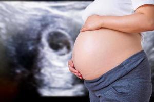 femme enceinte avec fond d'équipement à ultrasons photo