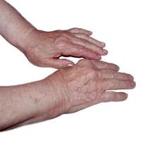 deux mains d'une femme âgée photo