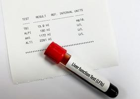 échantillon de sang isolé pour test de la fonction hépatique ou lfts, y compris alt, ast, alp et bilirubine totale avec rapport patient anormal. photo