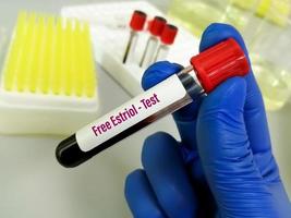 échantillon de sang pour test d'estriol gratuit en laboratoire. photo