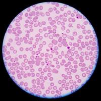 cellule sanguine des thrombocytes plaquettaires. photo