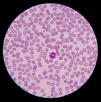 cellules sanguines médicales. photo
