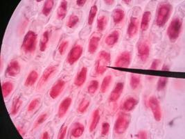 cellules saines vivantes (mitose) - micro-photo originale du tissu