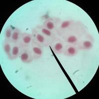 cellules saines vivantes (mitose)