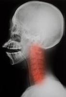 radiographie: crâne latéral - blessure au cou