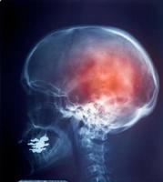 IRM des rayons X du col de la colonne vertébrale et du stress de la tête