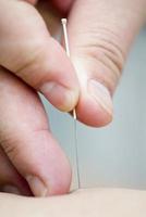 Close up main tenant une aiguille d'acupuncture pendant le traitement