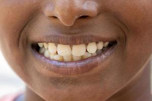 bébé sourire proche. Dents blanches d'un enfant isolé sur fond blanc photo