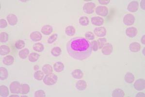 lymphocyte photo