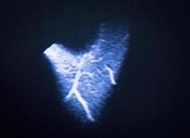 imagerie par résonance magnétique IRM