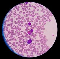 cellules sanguines médicales. photo