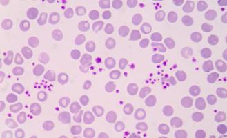 thrombocyte photo