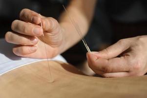 acupuncture.ch traitement de médecine chinoise