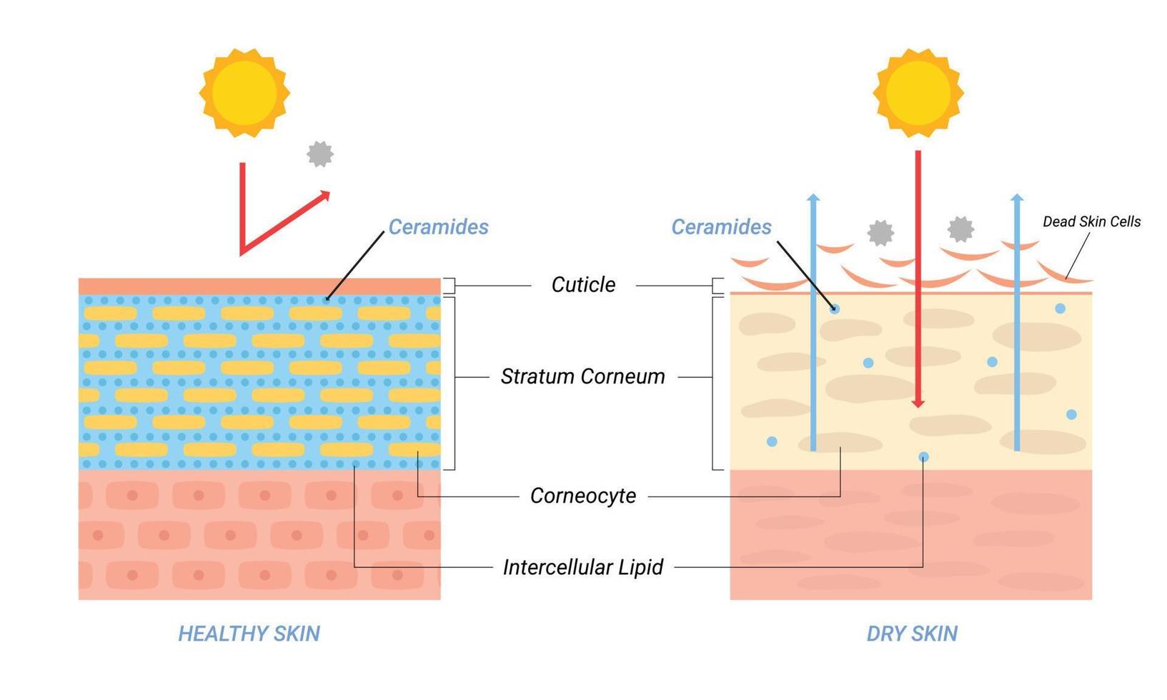 illustration de la couche de peau sèche et saine. concept de beauté et de soins de la peau vecteur