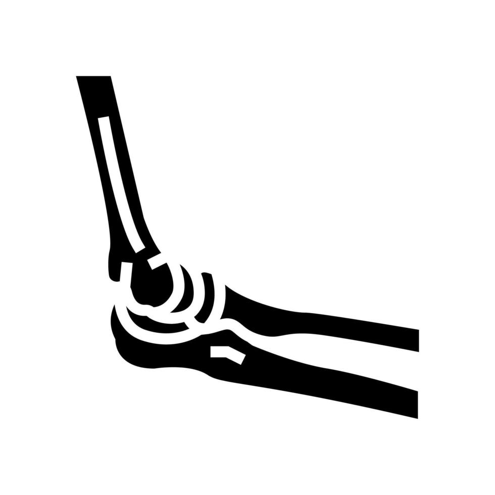illustration vectorielle d'icône de glyphe d'os de coude vecteur