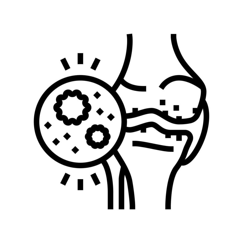 illustration vectorielle de l'icône de la ligne d'arthrite infectieuse vecteur