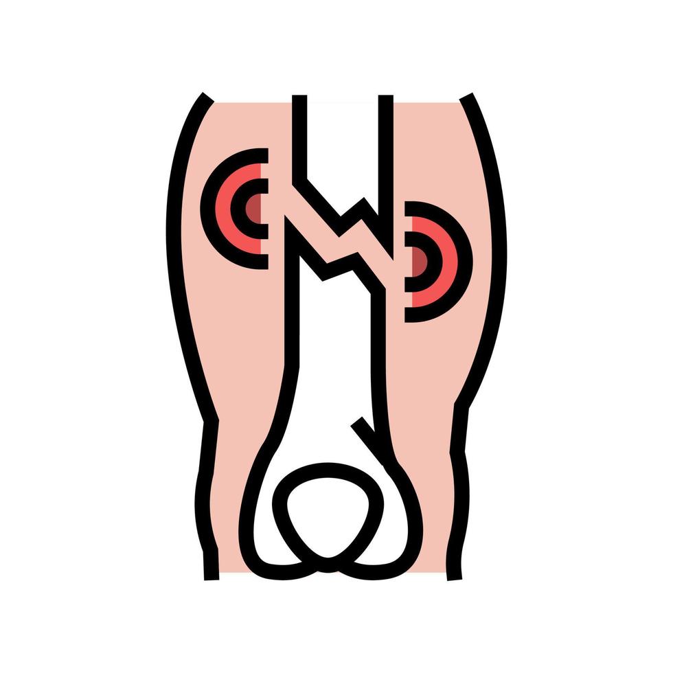 illustration vectorielle d'icône de couleur de maladie de fracture de membre fermé vecteur