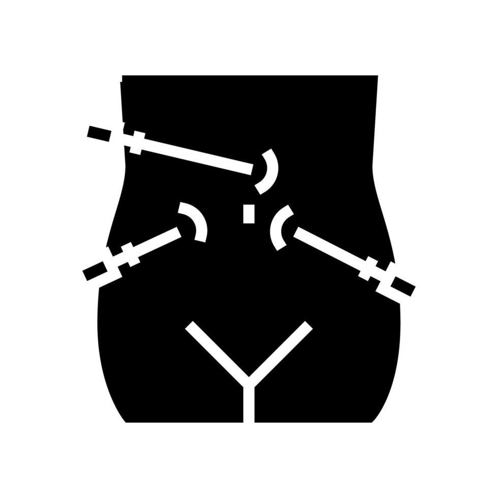 illustration vectorielle de l'icône de la ligne bariatrique laparoscopie vecteur