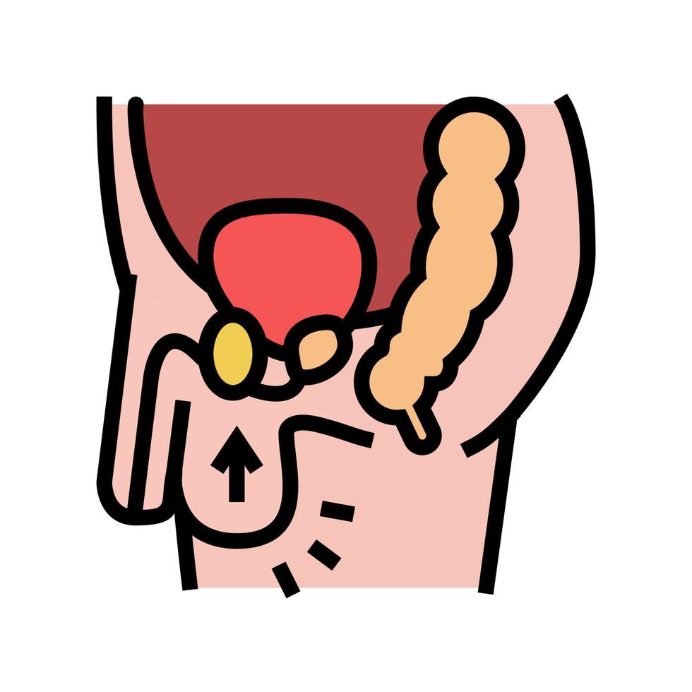 illustration vectorielle de l'icône de couleur de la maladie de cryptorchidie vecteur