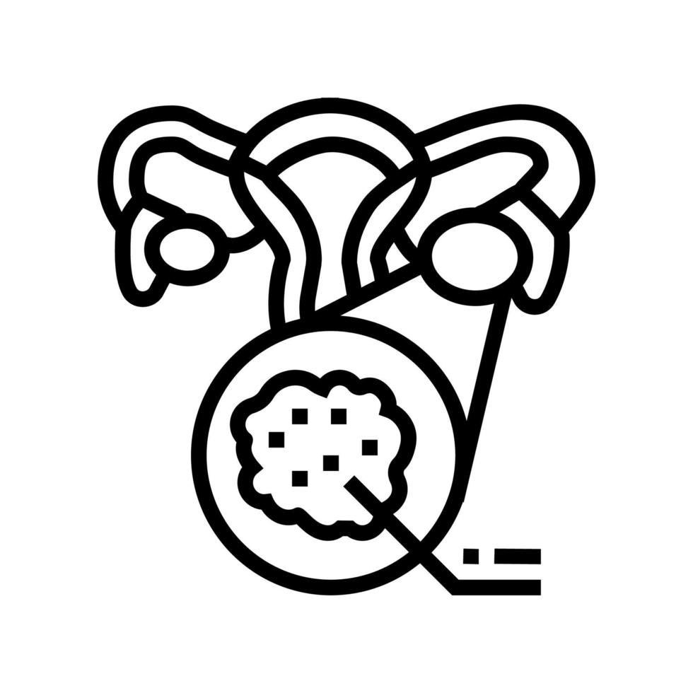 illustration vectorielle de l'icône de la ligne d'endocrinologie du syndrome des ovaires polykystiques vecteur