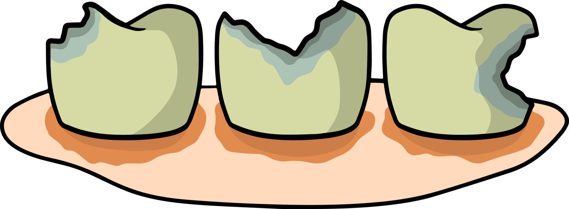 caries et problèmes dentaires. dentisterie et dents sales malades avec des taches. hygiène buccale. soins médicaux. gingivite. le besoin de nettoyage. carie. illustration de dessin animé vecteur