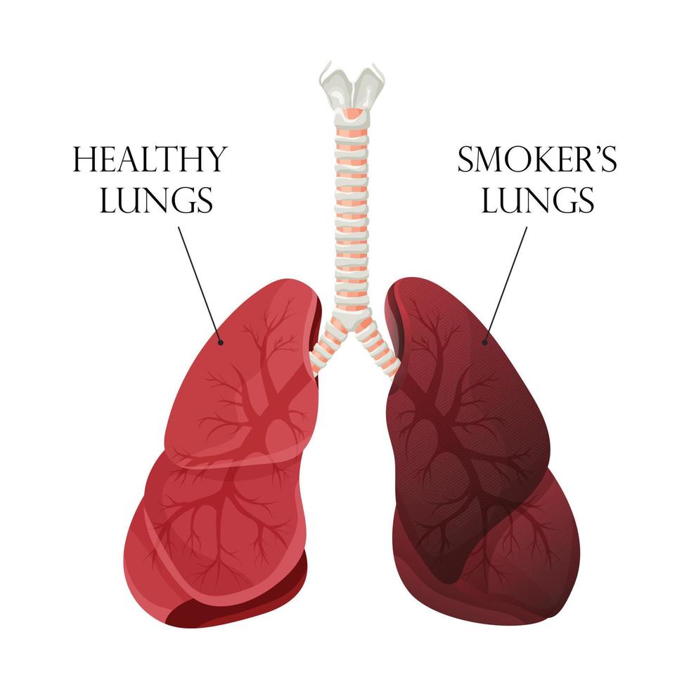 illustration de poumons sains normaux et d'un fumeur de poumons. concept d'arrêter de fumer. illustration vectorielle. vecteur