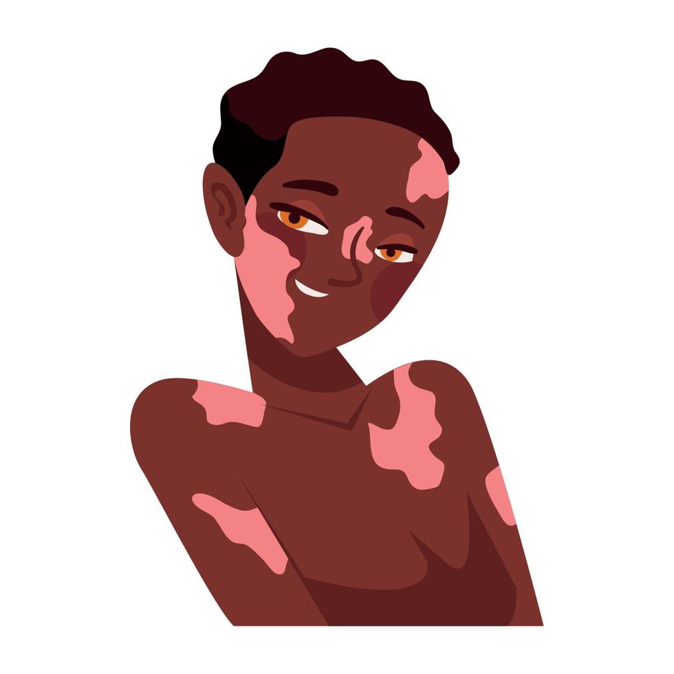 femme afro avec vitiligo vecteur
