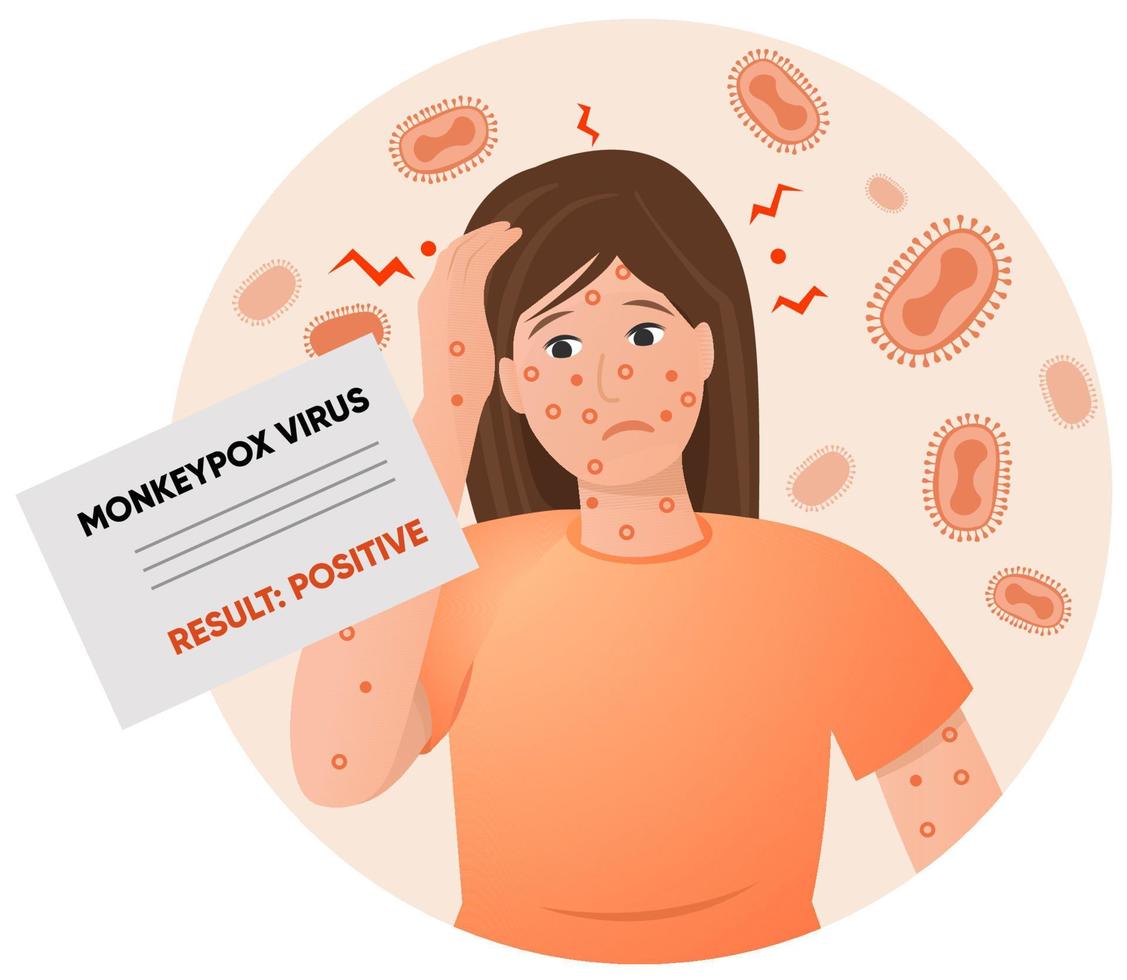femme malade avec éruption cutanée sur le visage et les mains et résultat positif du test du virus monkeypox. illustration vectorielle vecteur