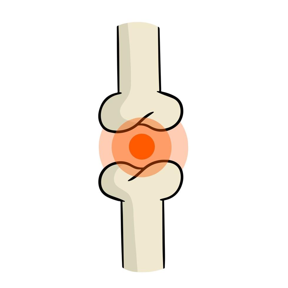 arthrite. maladie des articulations. os et cartilage interosseux. biologie et anatomie. formation médicale et chirurgie. point sensible rouge. illustration de dessin animé vecteur