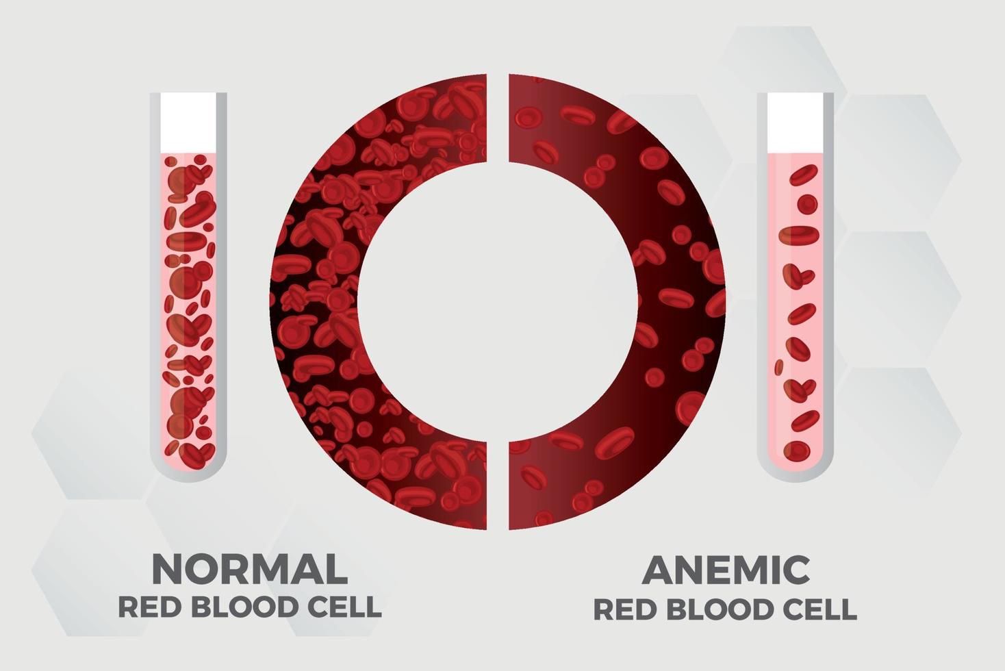 anémie fer globules rouges médical illustration vectorielle médical. vecteur