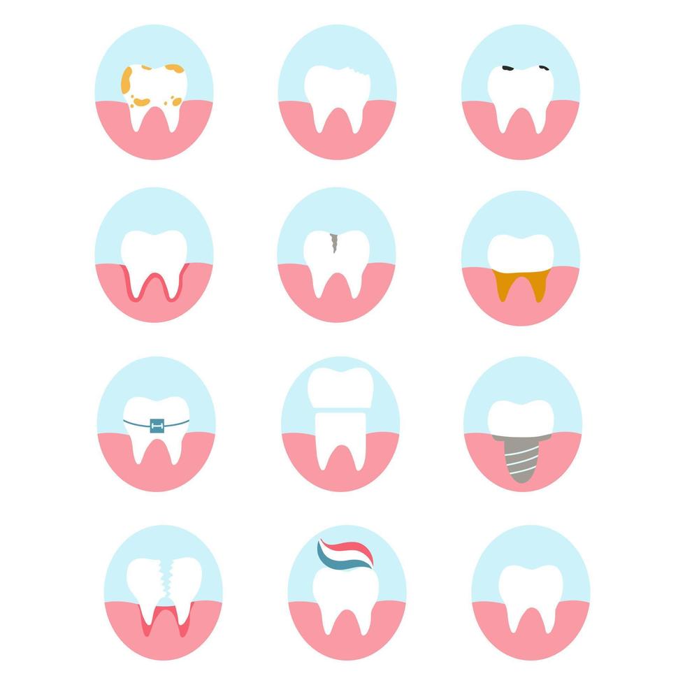 ensemble d'icônes de dents. illustration vectorielle de diverses maladies dentaires et de l'état des dents, comme la carie, la fissure, la scission, l'implant, la gingivite, la dent de sagesse pour la brochure, la bannière, la clinique dentaire, le logo vecteur