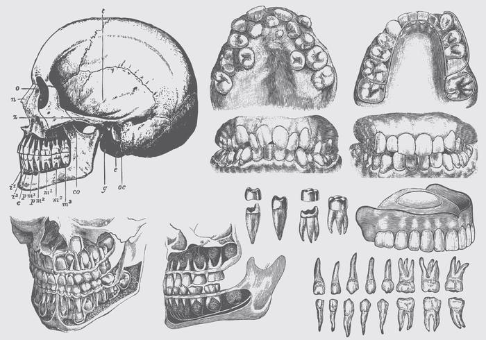 Illustrations de la maladie dentaire vecteur