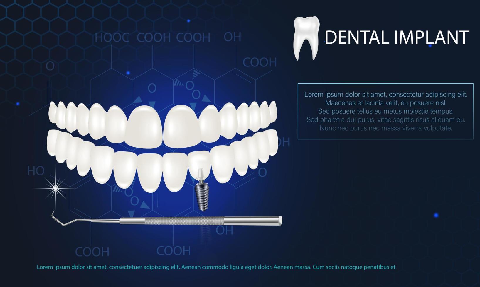implant dentaire blanc réaliste sur fond bleu. modèle vectoriel 3d d'une dent avec un fil.