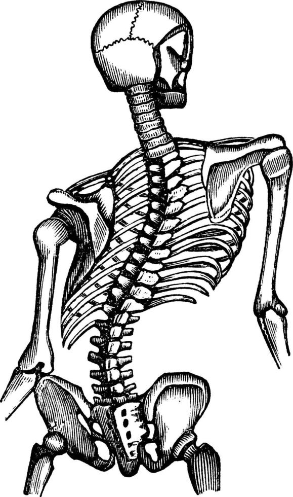 thorax déformé, illustration vintage. vecteur