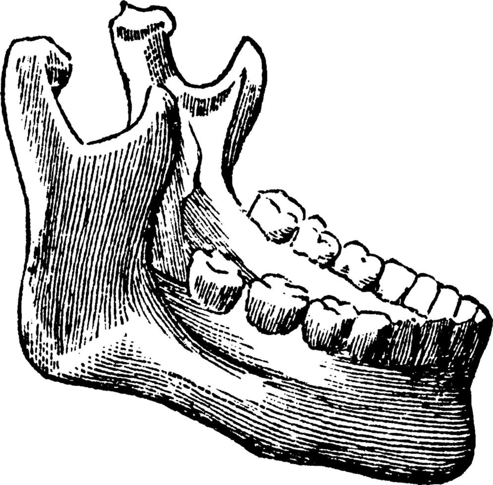 maxillaire, illustration vintage. vecteur