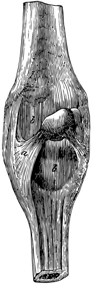 ligaments superficiels du carpe, illustration vintage. vecteur