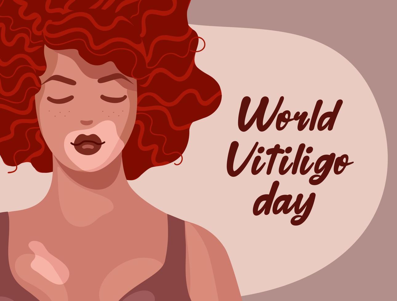 belle femme rousse, vitiligo sur peau claire et cheveux bouclés ondulés. illustration vectorielle de concept positif de corps. journée mondiale du vitiligo. maladie de dépigmentation cutanée. pour affiches, cartes postales, bannières. vecteur