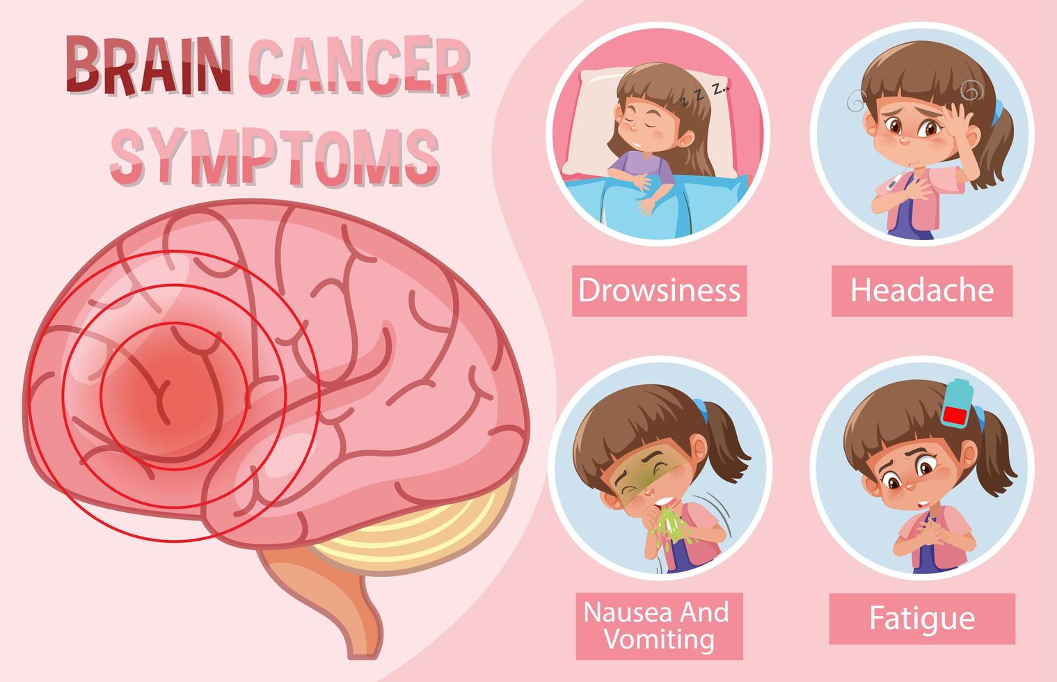 informations médicales sur les symptômes du cancer du cerveau vecteur