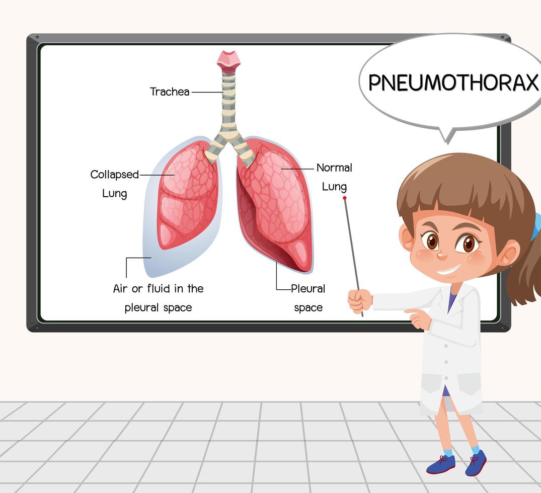 Un jeune scientifique explique le pneumothorax devant un tableau en laboratoire vecteur