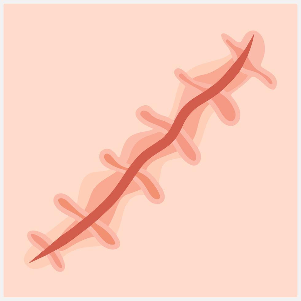 ensemble vectoriel réaliste de sutures chirurgicales et de cicatrices, plaies cousues à différents stades de guérison