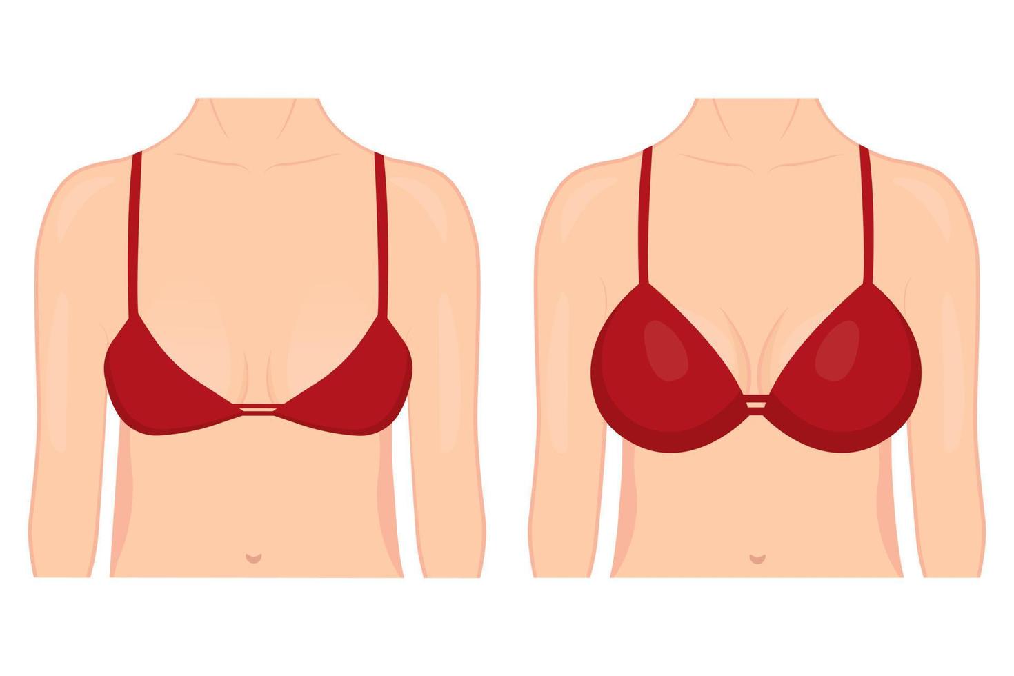 buste de femme avant et après chirurgie plastique pour augmentation mammaire. une femme en soutien-gorge avec différentes tailles de poitrine sur fond blanc. pour la publicité et les publications médicales. vecteur