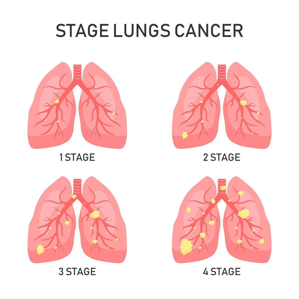 concept de vecteur de cancer du poumon. illustration vectorielle.