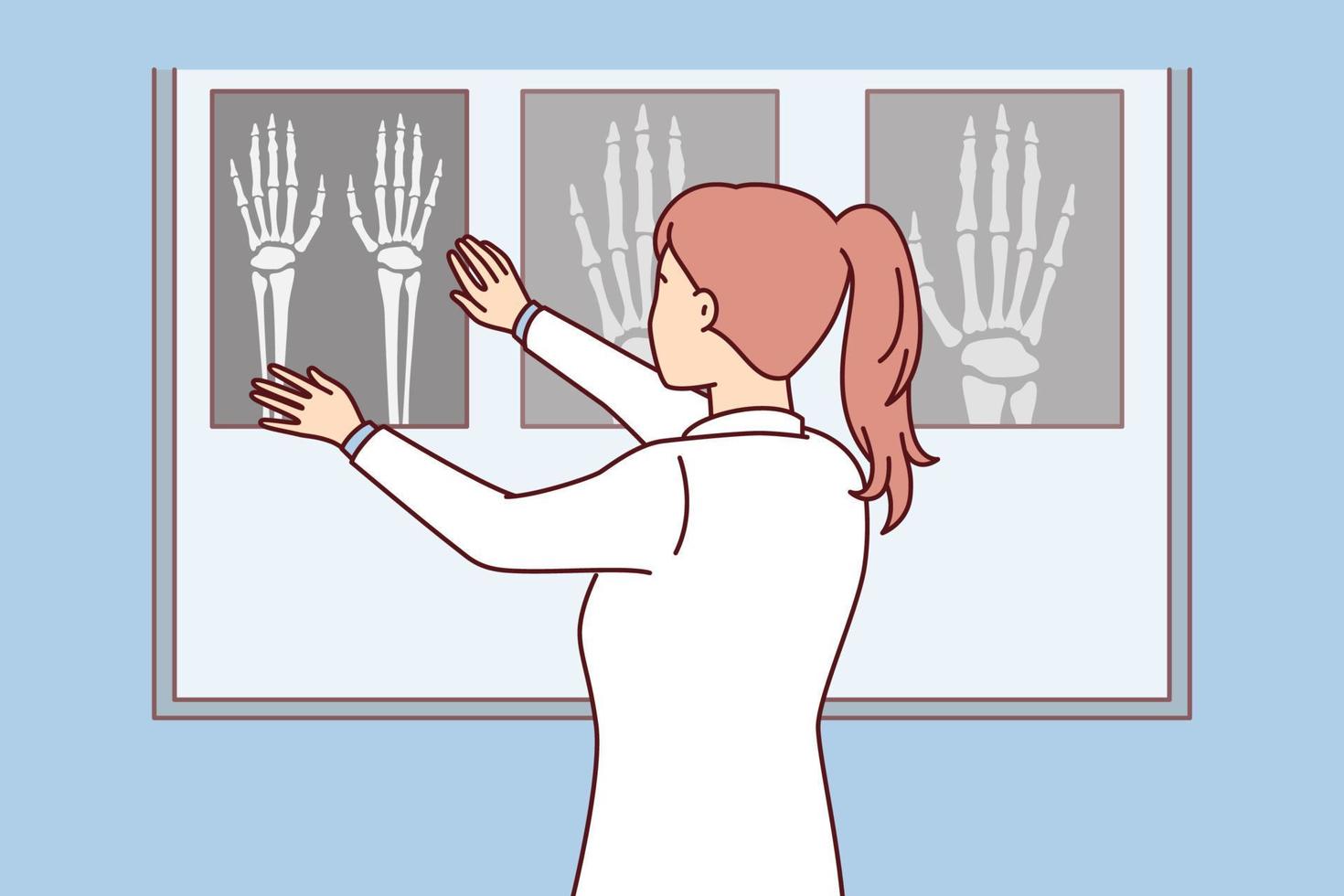 une femme chirurgienne applique une radiographie de la main sur un tableau lumineux pour voir les sites de fracture osseuse chez le patient. une infirmière se tient dos à l'écran en regardant des images faites après une fracture. conception de vecteur plat