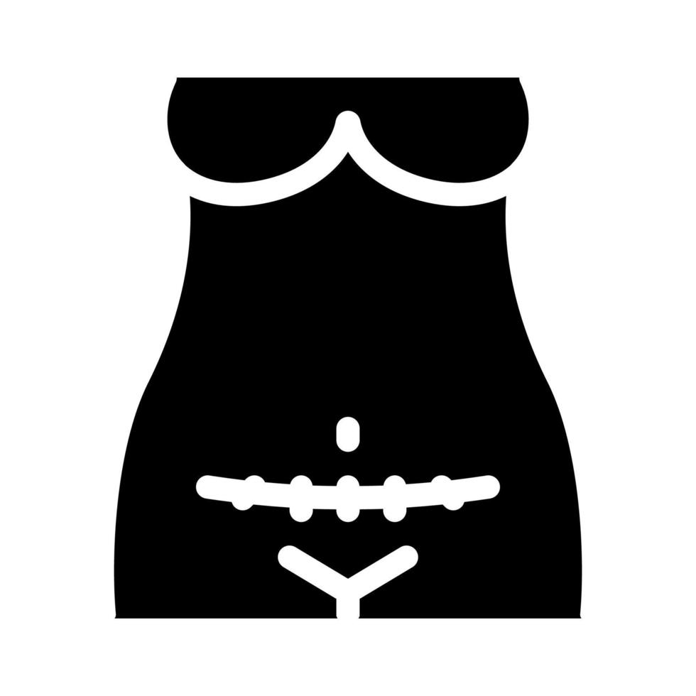 illustration de glyphe vectoriel icône césarienne