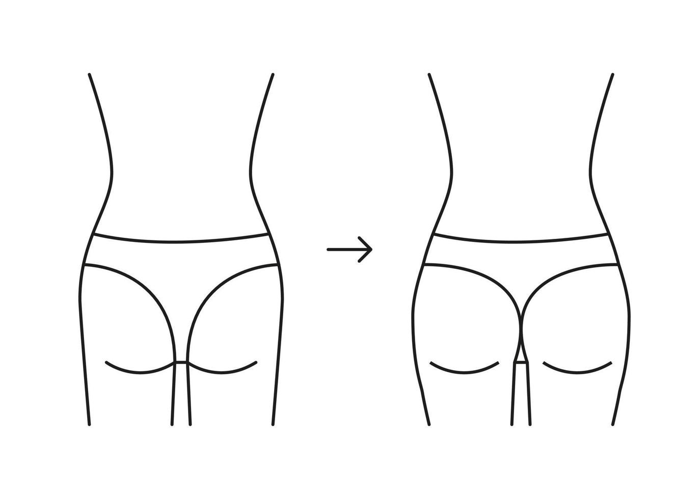 types de fesses femme, forme fesse dos, icône de la ligne. augmentation, remodeler les fesses à plat en plein butin. procédures médicales esthétiques, clinique de chirurgie plastique. illustration de contour de vecteur