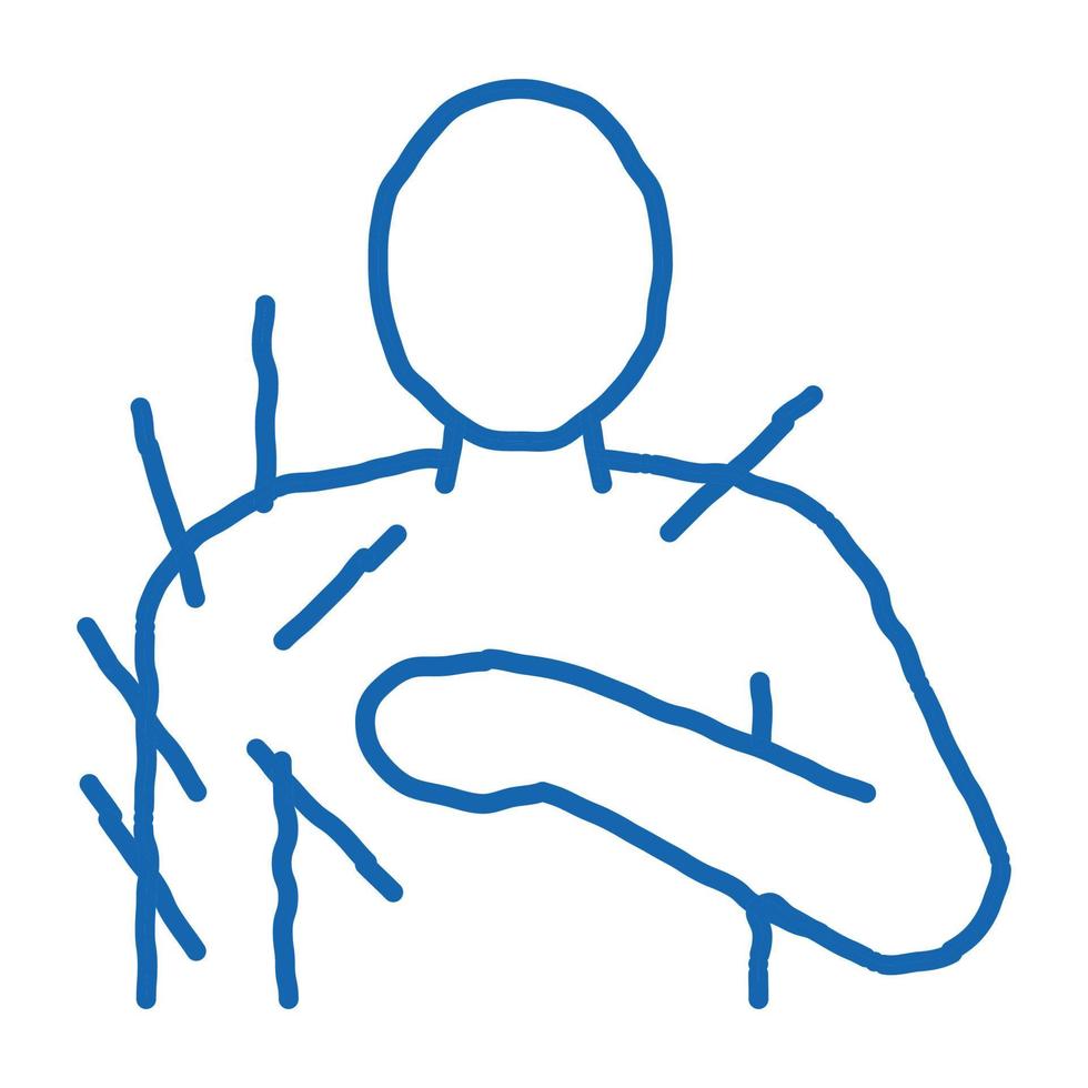 acupuncture épaule doodle icône illustration dessinée à la main vecteur