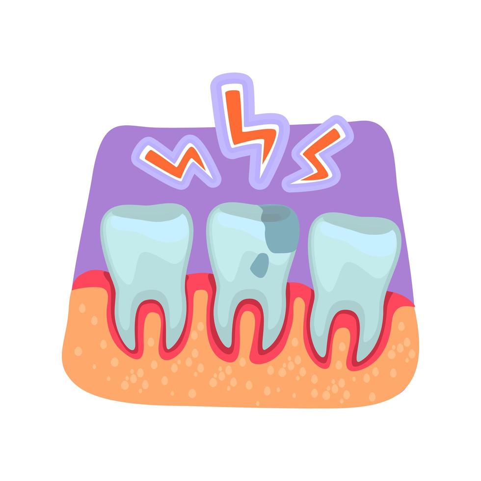 illustration vectorielle de mal de dents concept plat vecteur